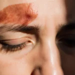 Woman gazes downward with surgical scar above eye showing vulnerability and emotional distress with soft side lighting